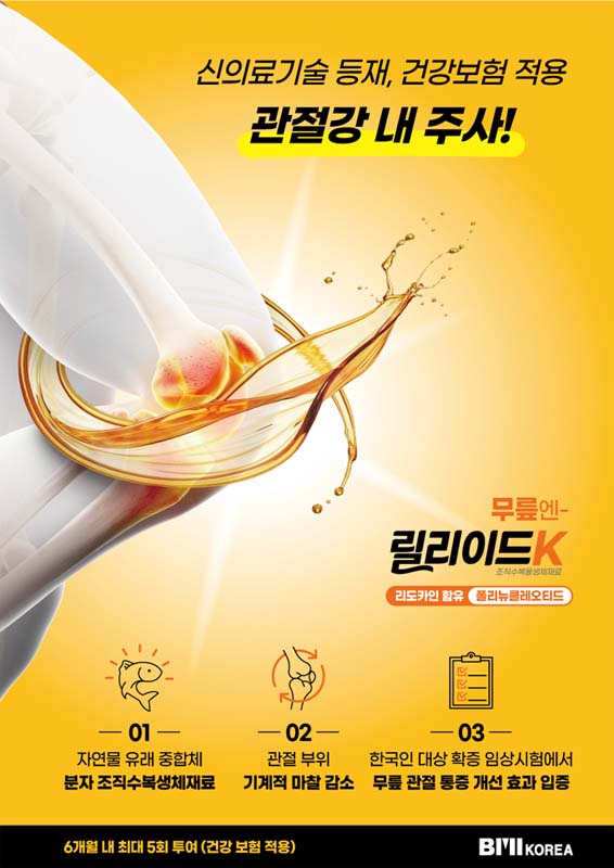 건강보험적용! 관절강 내 주사, 신의료기술 등재