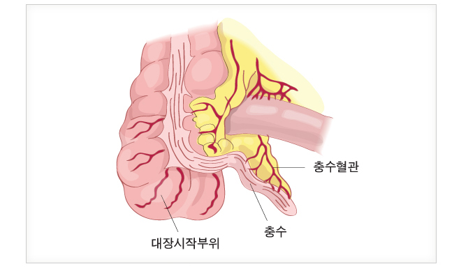 충수 위치 — 대장 시작 부위와 충수혈관