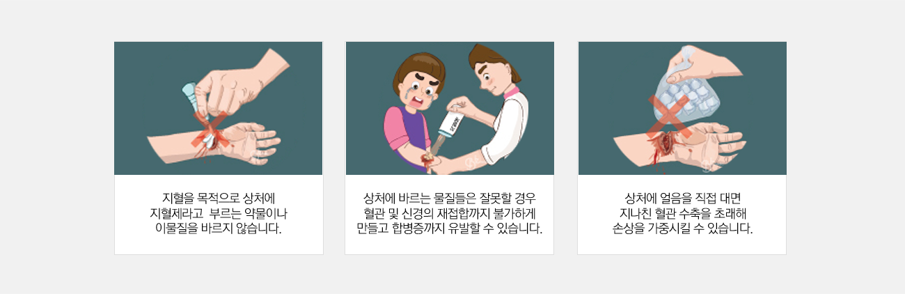 어린이외상 안내