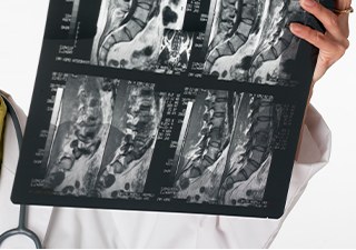 의료진이 요추 MRI 필름을 판독하는 모습