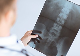 의료진이 척추 X-ray 필름을 확인하는 모습