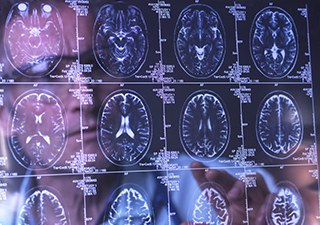 의료진이 뇌 MRI 영상을 판독하는 모습