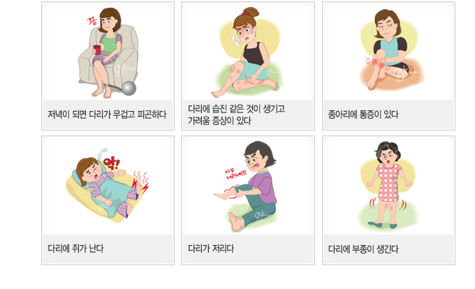 하지정맥류 의심 증상 — 다리가 무겁고 피곤하다, 습진·가려움, 종아리 통증, 쥐, 저림, 부종